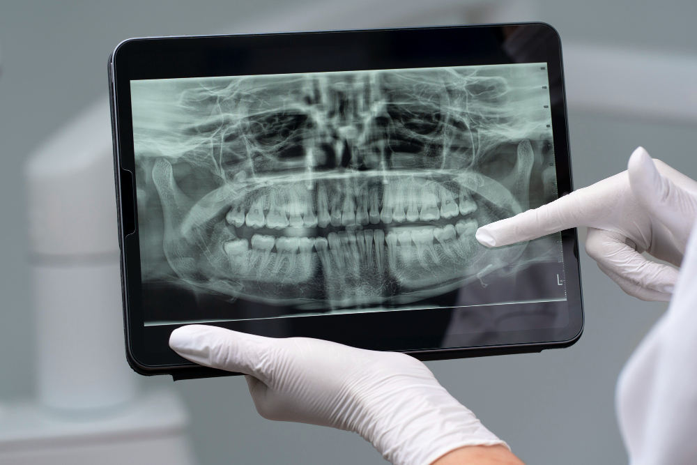 Digital X-Rays Milpitas, CA