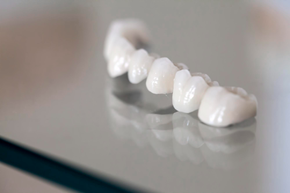 Porcelain Crowns Milpitas, CA
