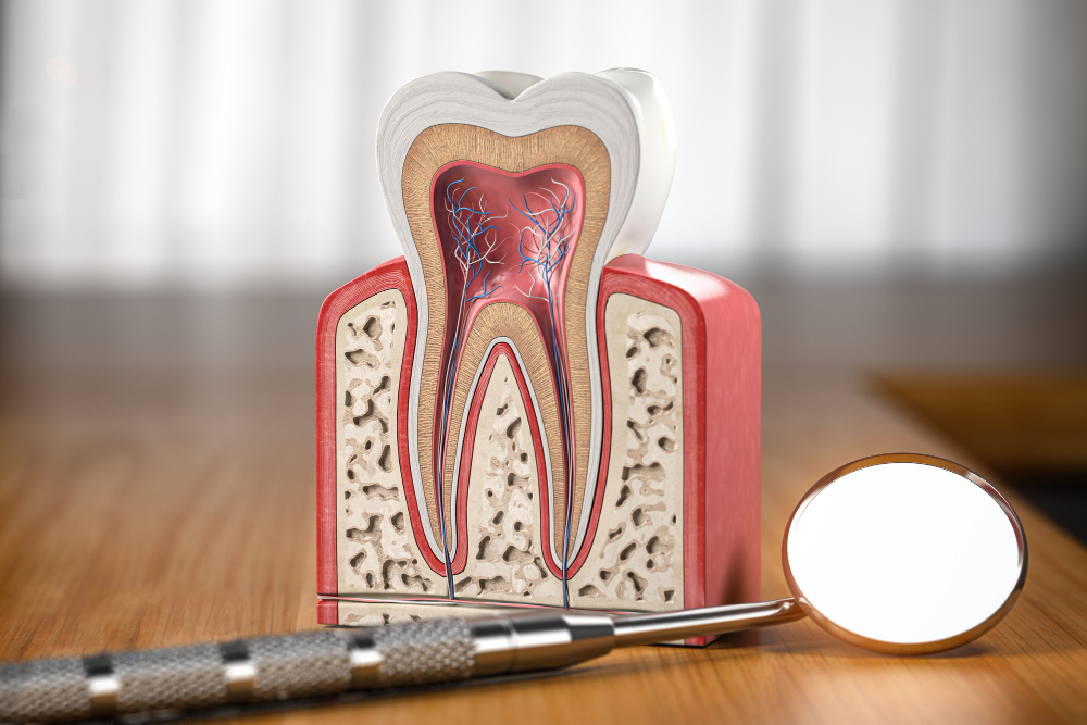 Root Canals Milpitas, CA